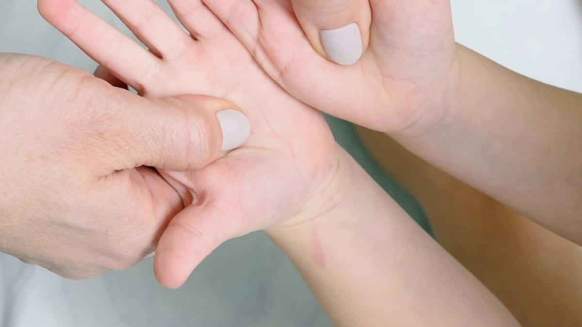 Polidactilia: Diagnóstico e Tratamento