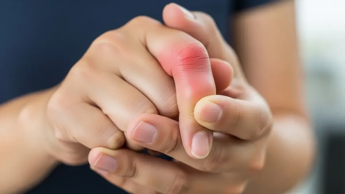 Torção No Dedo Da mão