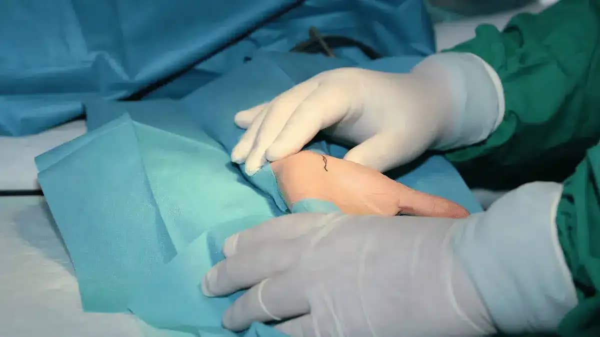 Artroscopia do Punho: Quais são os Benefícios