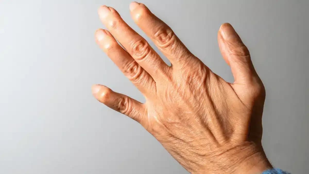 Deformidades do Dedo Mínimo: Guia Completo