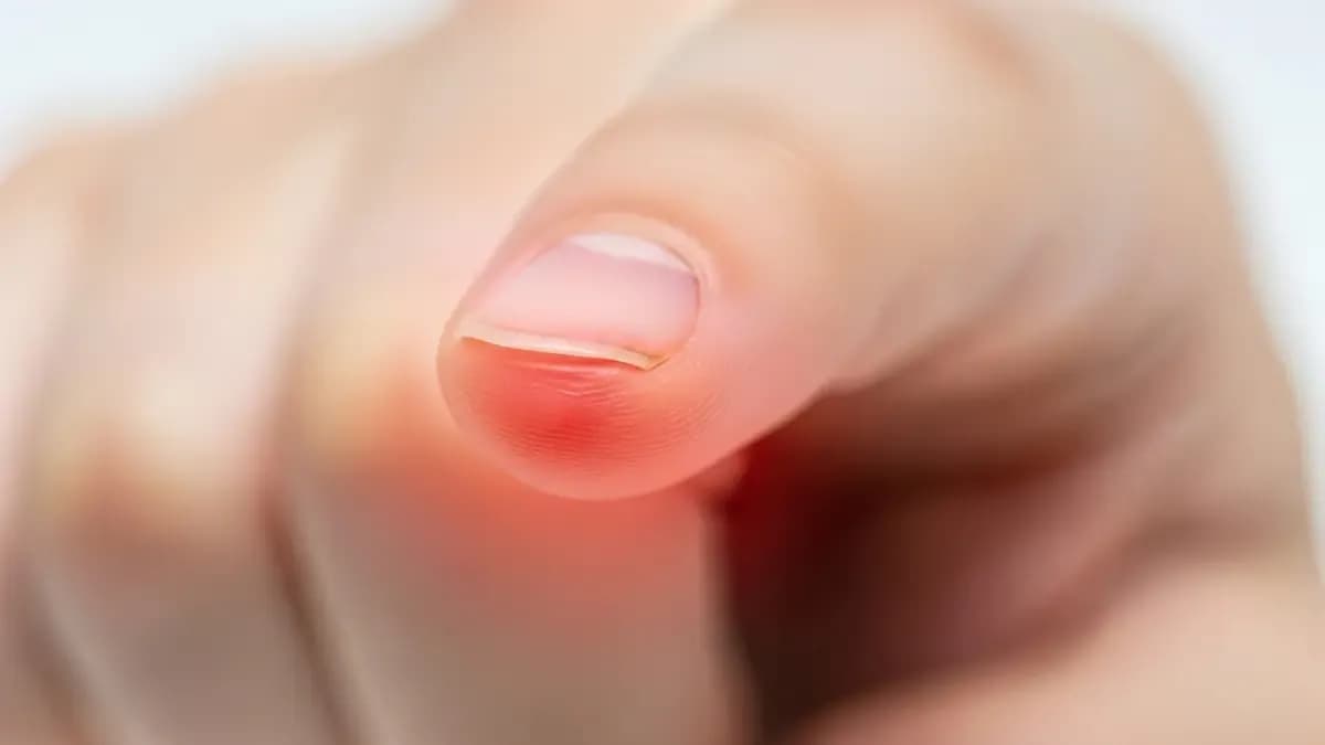 Dor na ponta do dedo da mão