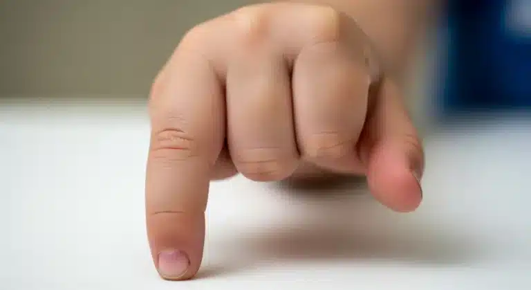 Macrodactilia