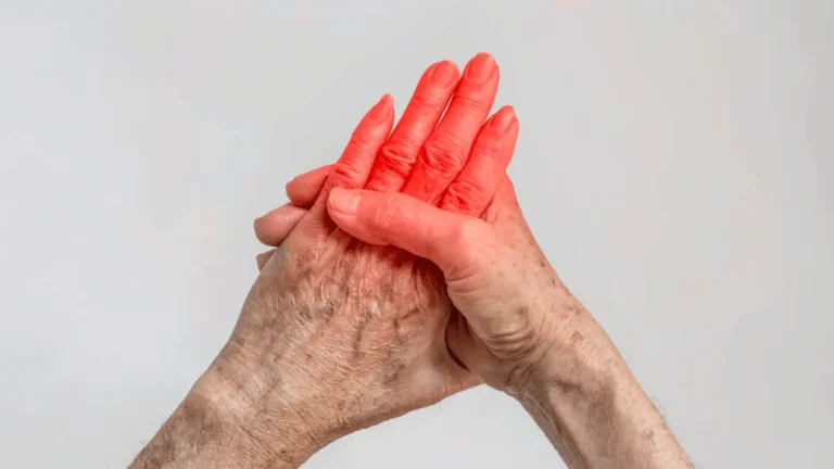 Queimação nas mãos à noite
